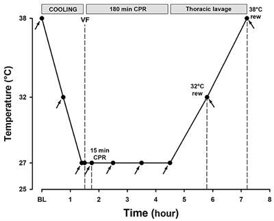 Rewarming With Closed Thoracic Lavage Following 3-h CPR at 27°C Failed to Reestablish a Perfusing Rhythm